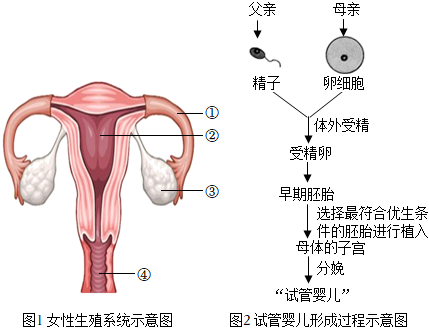 高龄孕妇