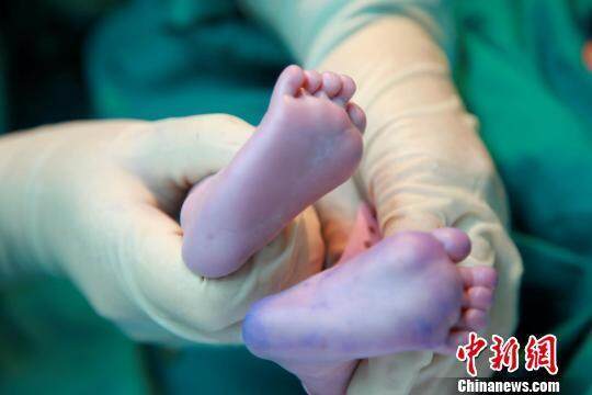 高龄试管婴儿