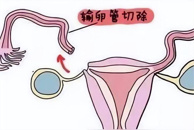 鞍山不孕不育