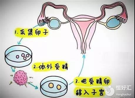 香港验血是男孩女孩